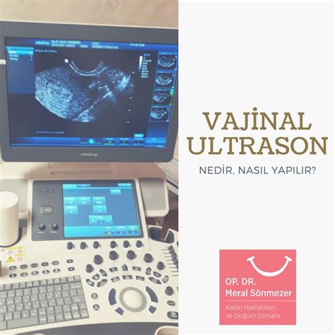 ultrason için nereden randevu alınır